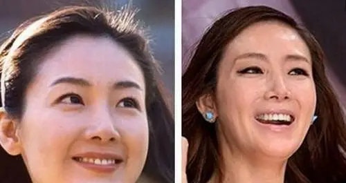 崔智友蔡琳李多海颜值变化_童年韩剧女主整容后遗症_韩剧整容女明星