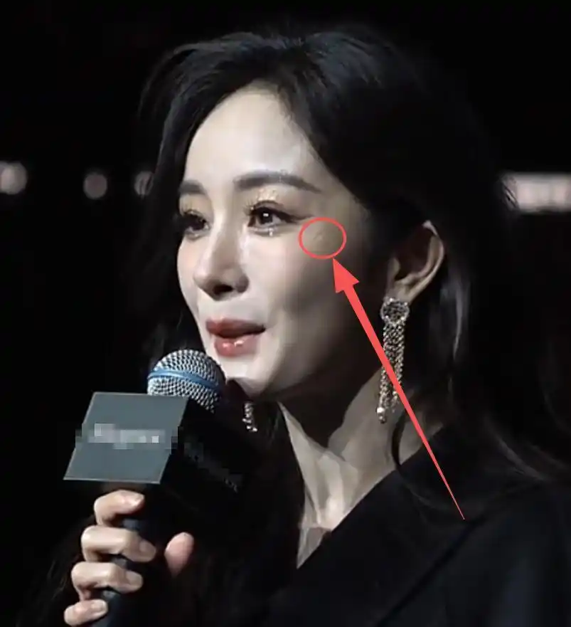 女明星卸妆前后对比_女明星脸上有疤痕_杨幂生图真实颜值